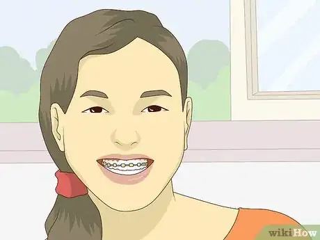 Image titled Wear Braces With Confidence and Style Step 8
