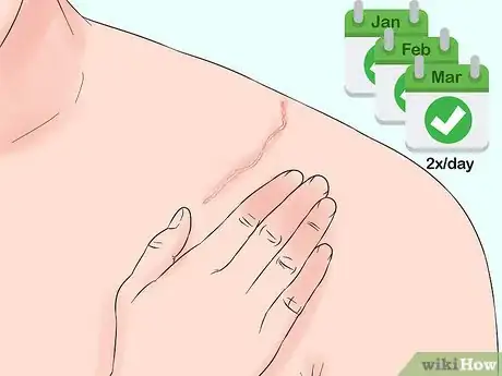 Image titled Use Bio Oil Step 3