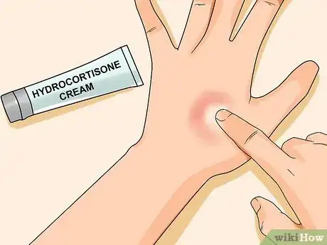 Image titled Know if You Have Sensitive Skin Step 14