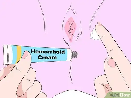 Image titled Stop Rectal Bleeding Step 12