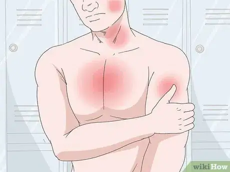 Image titled Tell the Difference Between Heartburn and a Heart Attack Step 2