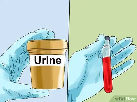 Image titled Stop Aching in Your Bones Step 3