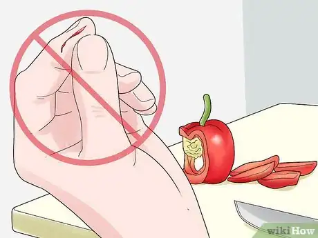 Image titled Prevent Psoriasis Step 9