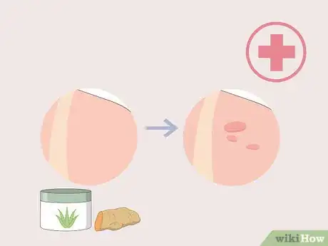 Image titled Get Fair Skin Naturally Step 16
