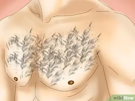 Image titled Undergo Testosterone Therapy Step 13