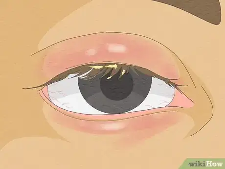 Image titled Use Eyelash Growth Serum Step 15