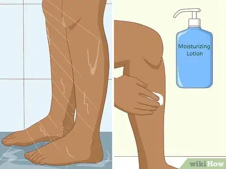Image titled Soothe Itchy Legs Step 17