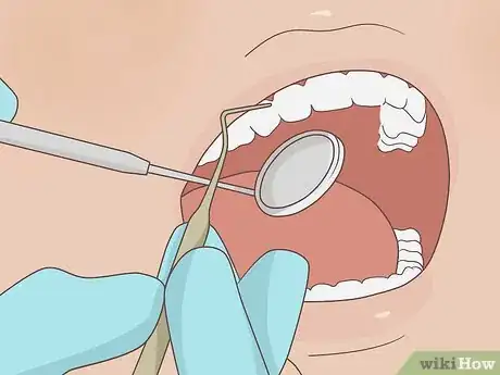 Image titled Prevent a Root Canal Step 3