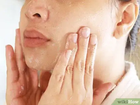 Image titled Use Jojoba Oil for Acne Step 5