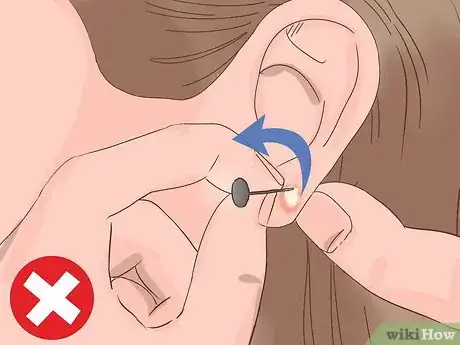 Image titled Treat an Infected Ear Piercing Step 2