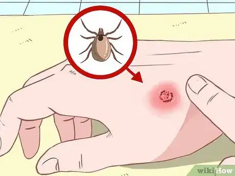 Image titled Prevent Q Fever (Coxiella Burnetii Infection) Step 3