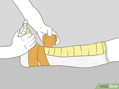Image titled Apply Splints Step 22