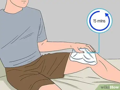 Image titled Care for a Bruise Naturally Step 7