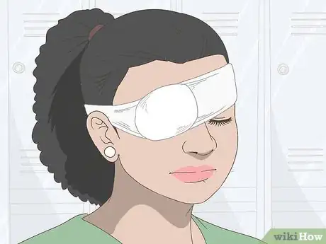 Image titled Treat Eye Sunburn Step 13