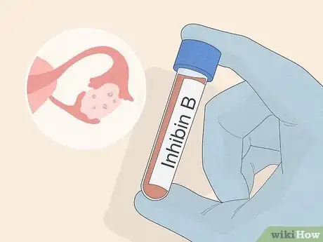Image titled Get Ovarian Reserve Testing Done Step 8