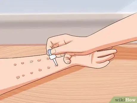 Image titled Recognize Peanut Allergies Step 9