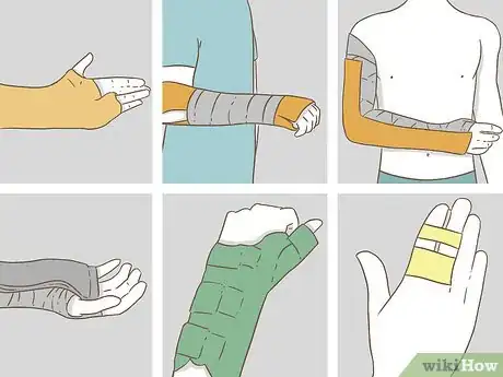 Image titled Apply Splints Step 10