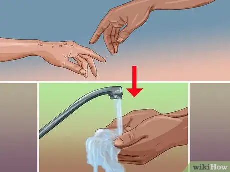 Image titled Pumice a Wart Step 9