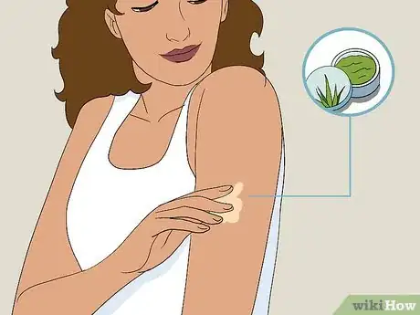 Image titled Care for a Bruise Naturally Step 4
