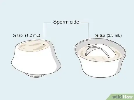 Image titled Use a Cervical Cap Step 4