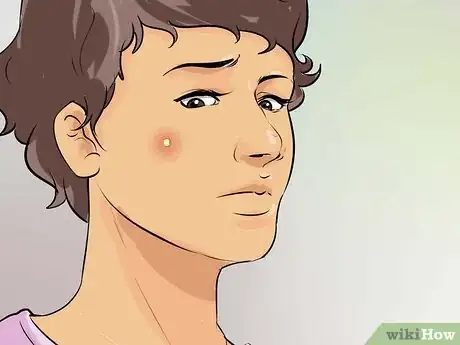 Image titled Prevent Body Acne Step 7