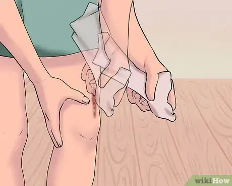 Image titled Use a Band Aid Step 13