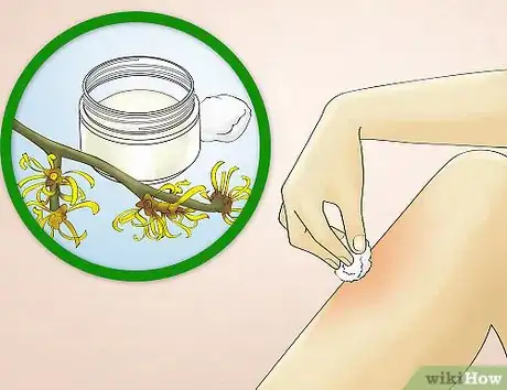 Image titled Reduce Redness After Waxing Step 2