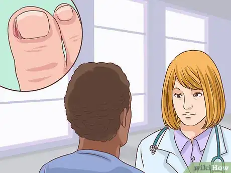 Image titled Treat a Torn Toenail Step 15