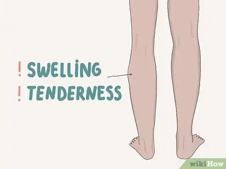 Image titled Diagnose and Treat Thrombophilia Step 1