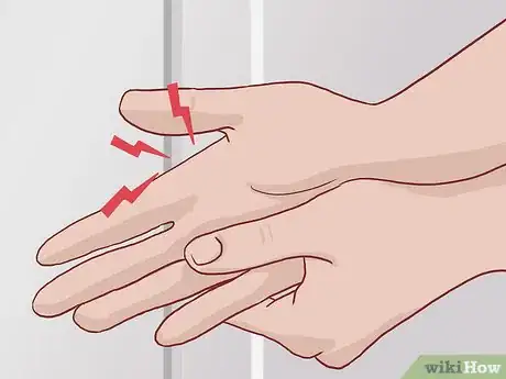 Image titled Know If Your Knuckle Is Broken Step 1