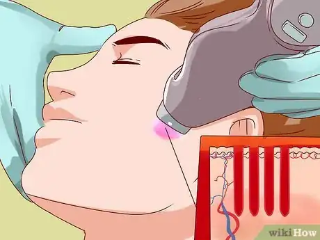 Image titled Choose Laser Skin Resurfacing Step 5