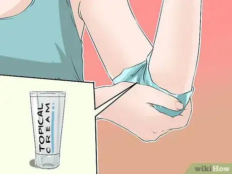 Image titled Treat Eczema in Children Step 5