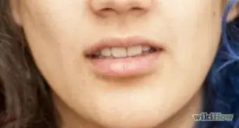 Avoid Hurting Insects