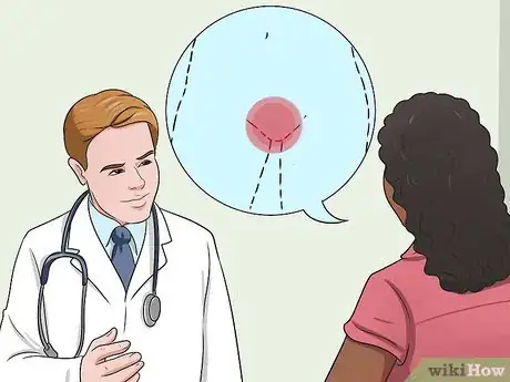 Image titled Stop Vaginal Itching Step 14