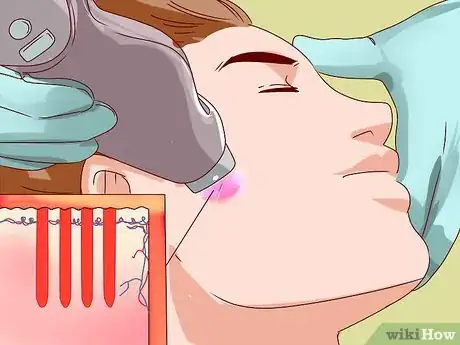 Image titled Choose Laser Skin Resurfacing Step 6