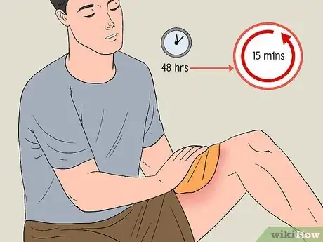 Image titled Care for a Bruise Naturally Step 8