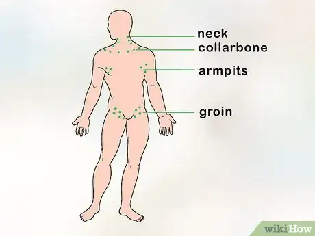 Image titled Check Lymph Nodes Step 1