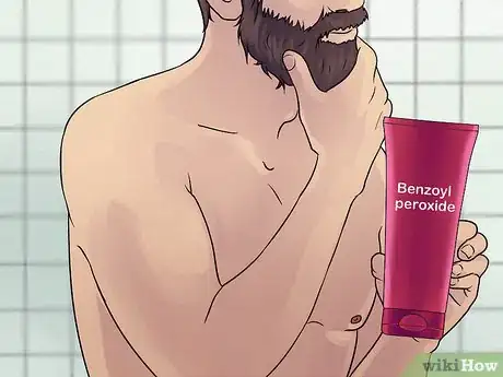 Image titled Prevent Chest Acne Step 1