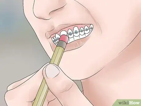 Image titled Be Happy with Braces Step 12