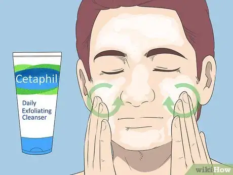 Image titled Get Rid of Acne if You Have Fair Skin Step 16