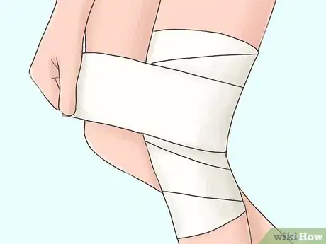 Image titled Prevent Knee Sprains Step 15