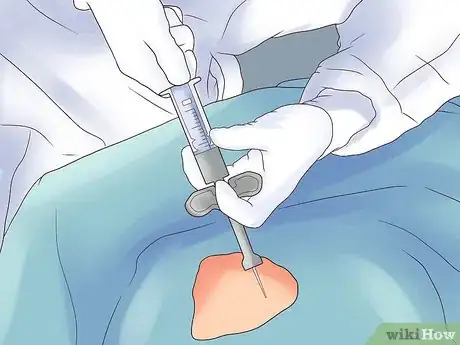 Image titled Prevent Leukemia in Children Step 20