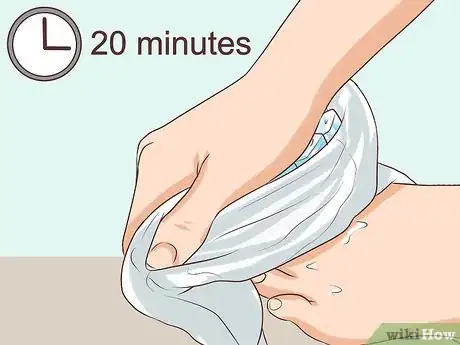 Image titled Treat a Torn Toenail Step 7