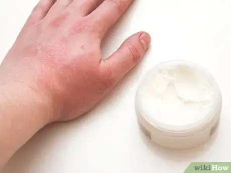 Image titled Eat Stinging Nettles Step 15