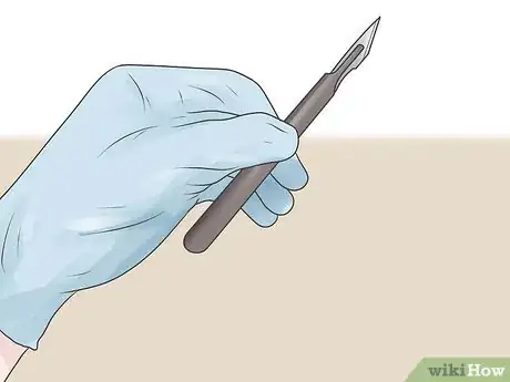 Image titled Prevent Macular Degeneration Step 19