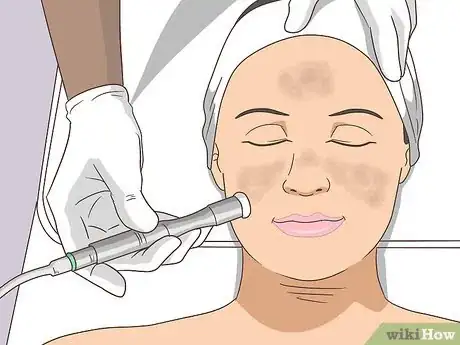 Image titled Treat Melasma Step 7