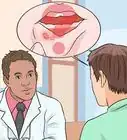 Heal Mouth Sores Caused by Chemotherapy