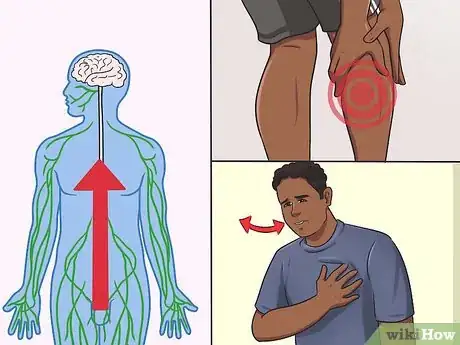 Image titled Recognize Zika Step 6