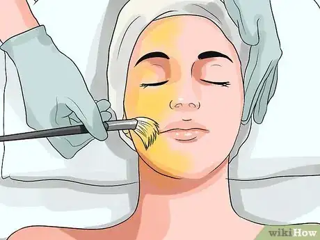 Image titled Clear up Acne With Hydrogen Peroxide Step 12