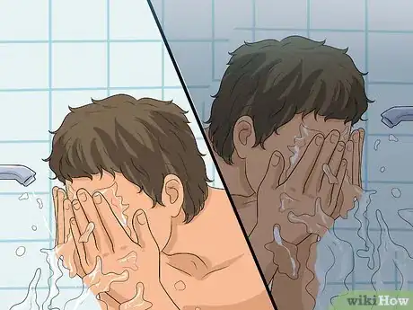 Image titled Get Rid of Acne Redness Step 2